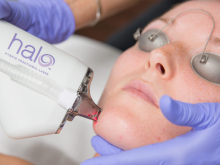 Halo Fractional Laser For Sale