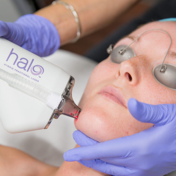 Halo Fractional Laser For Sale